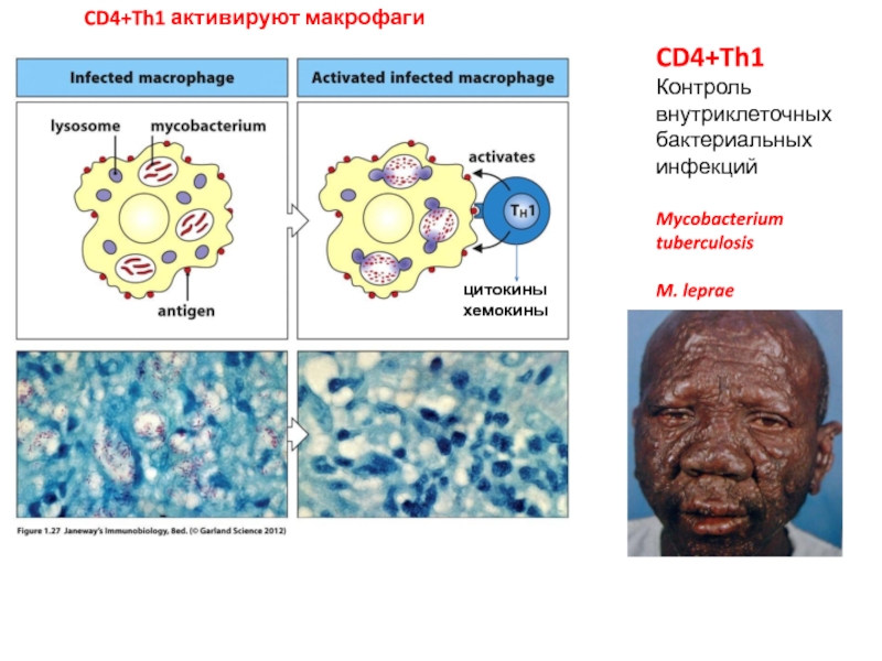 Активация макрофагов. CD 4 лимфоцитов 50 клеток/мм3. Cd4 лимфоциты это. Cd4. Макрофаги CD.