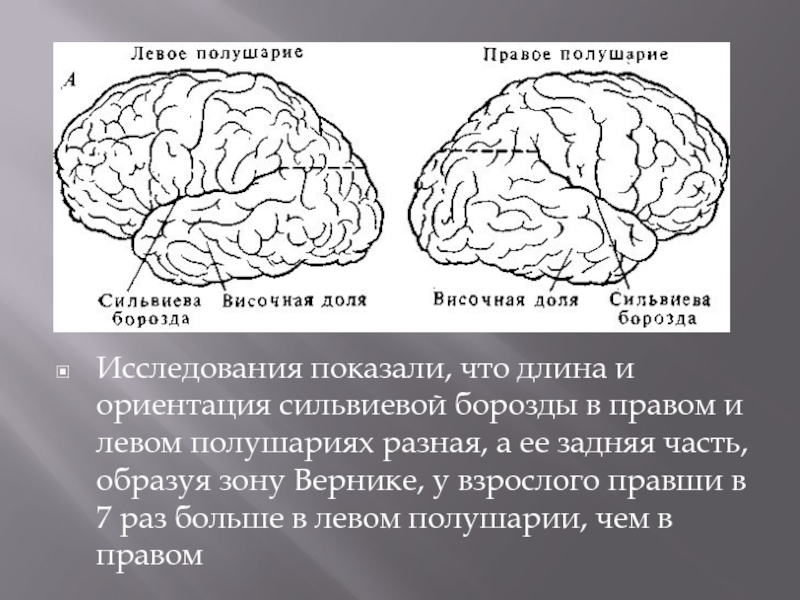 Поражение левого полушария мозга. Сильвиева борозда головного мозга. Роландова и сильвиева борозда. Сильвиева борозда разделяет мозг на. Анатомия плода сильвиева борозда.
