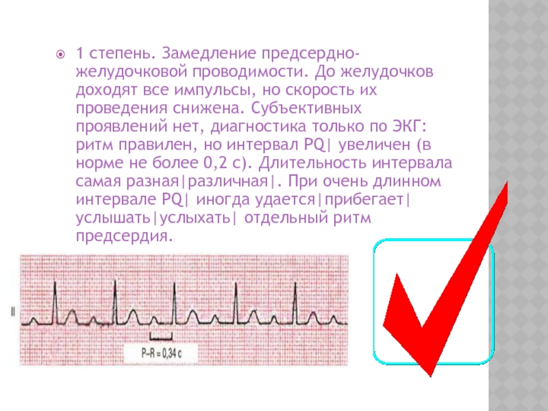 Замедленное проводимость. Блокада 1 степени в кардиограмме. Предсердно-желудочковая блокада. Замедление желудочковой проводимости. Нарушение предсердно-желудочковой проводимости это.