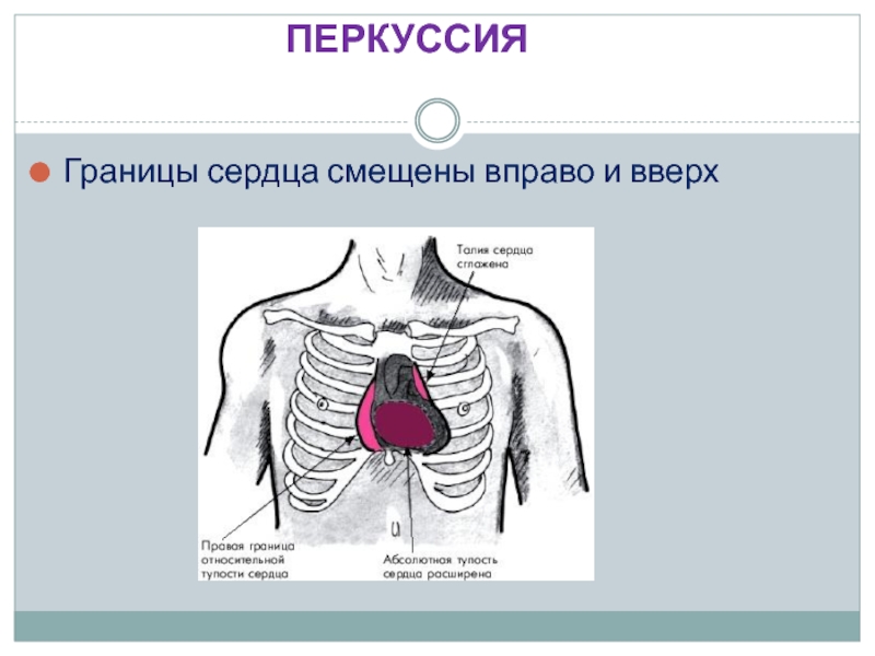 Границы сердца фото