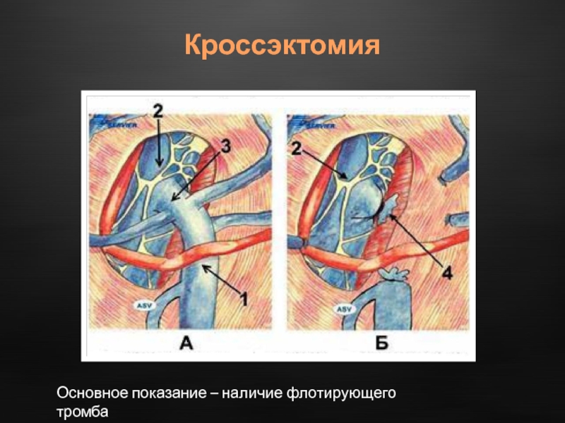 Операция троянова