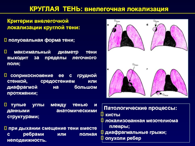 Анатомическим субстратом легочного рисунка в норме является