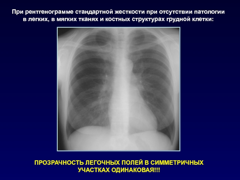 План описания рентгенограммы легких