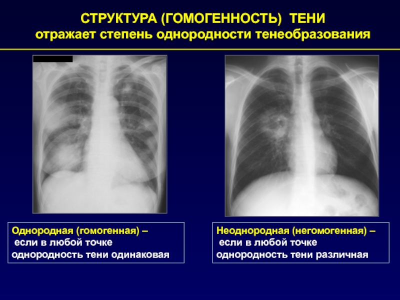 Рентгеновское изображение получают в результате неоднородного