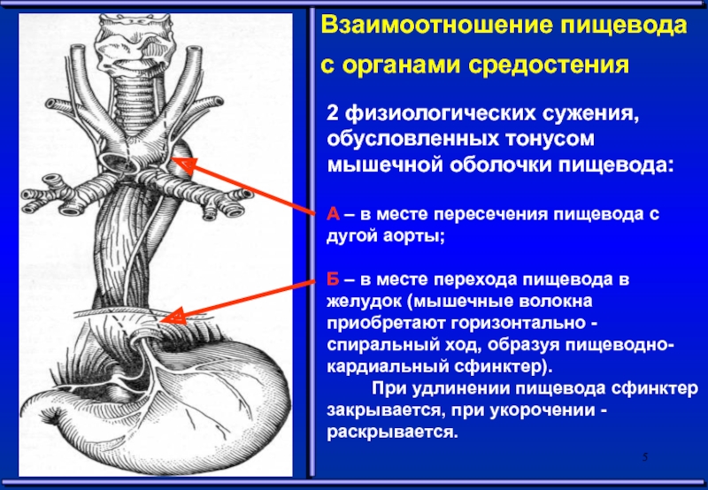 Заболевания пищевода хирургия презентация