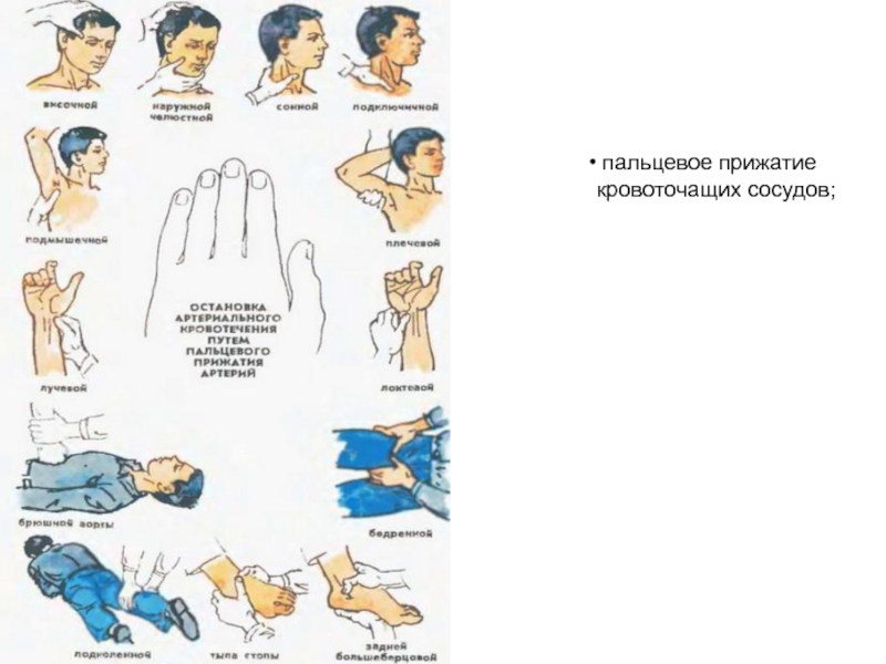 Картинки пальцевое прижатие артерии