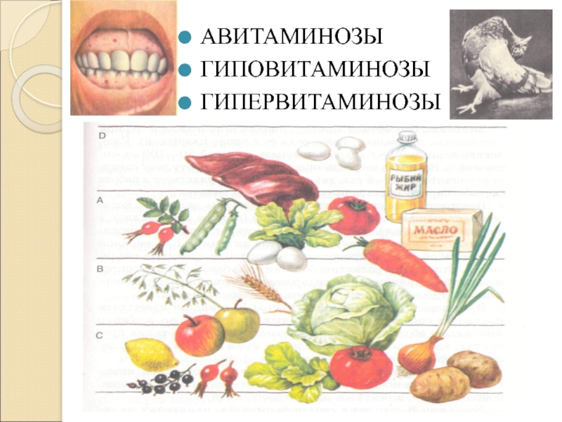 Авитаминоз в картинках