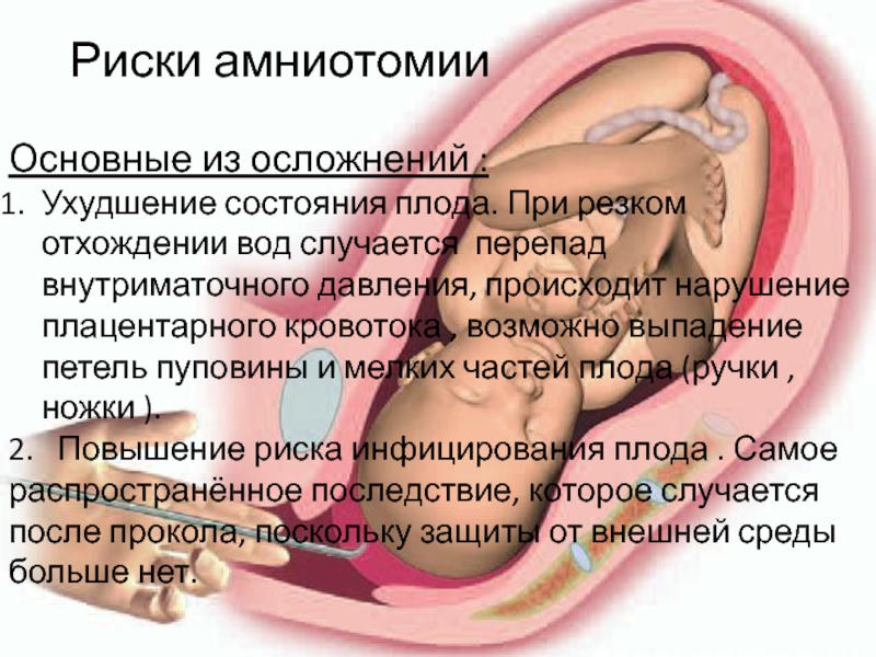 Осложнения во время родов. Нарушение кровотока плода. Кровоток в пуповине при беременности. Нарушение плацентарного кровообращения. Нарушение пуповинного кровотока.