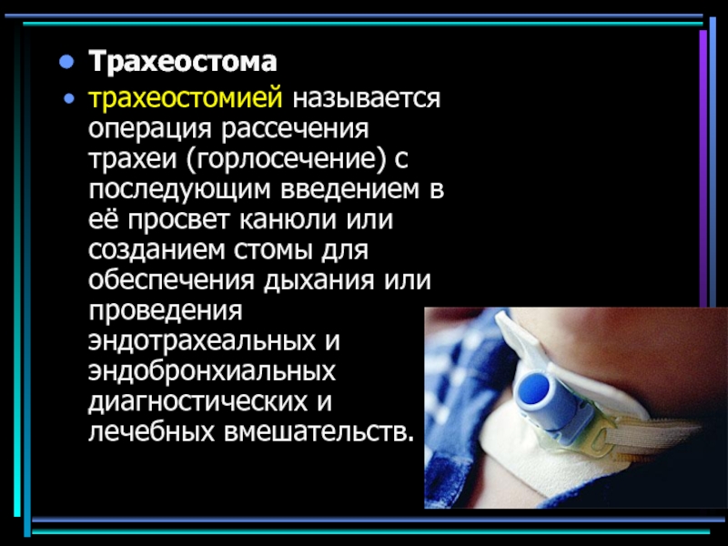 Трахеостома уход презентация