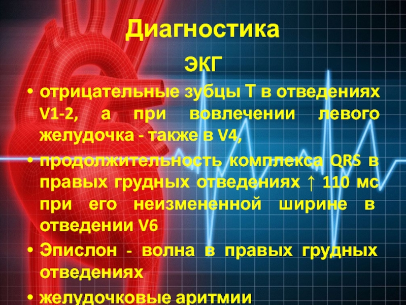 Экг отрицательный. Отрицательный т в стандартных отведениях. Отрицательный зубец т на ЭКГ. Отрицательный т зубец на ЭКГ В первом отведении. Отрицательный т на ЭКГ В грудных отведениях.