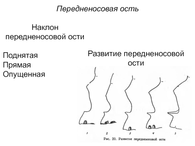 Ость это. Проводная ость и угол наклонения.