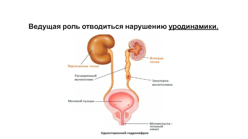 Мочеточник у женщин фото