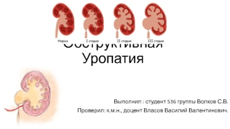 Обструктивная уропатия