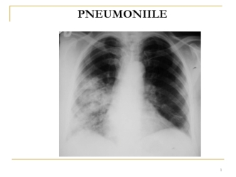 Pneumoniile