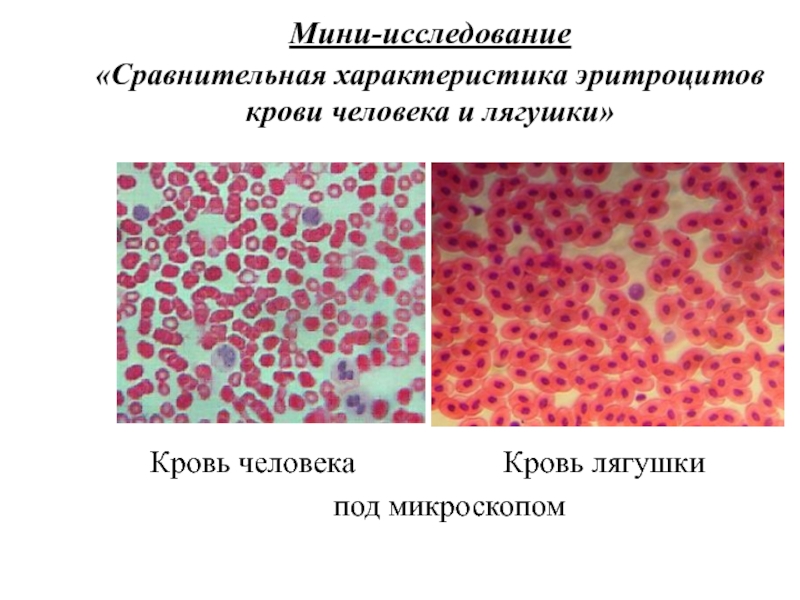 Исследование крови лягушки какая биологическая наука. Эритроциты в крови лягушки под микроскопом. Кровь лягушки гистология. Препарат крови человека и лягушки под микроскопом. Кровь человека и лягушки под микроскопом.
