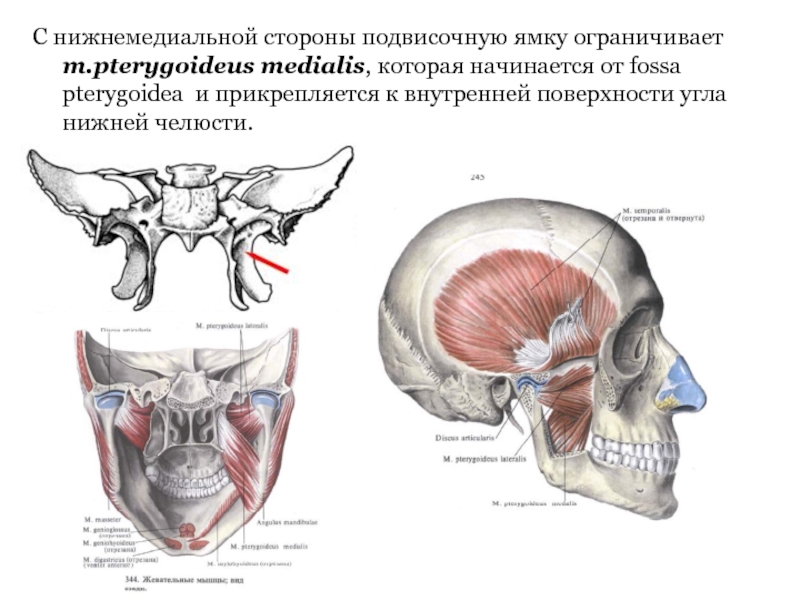 Подвисочный гребень клиновидной кости