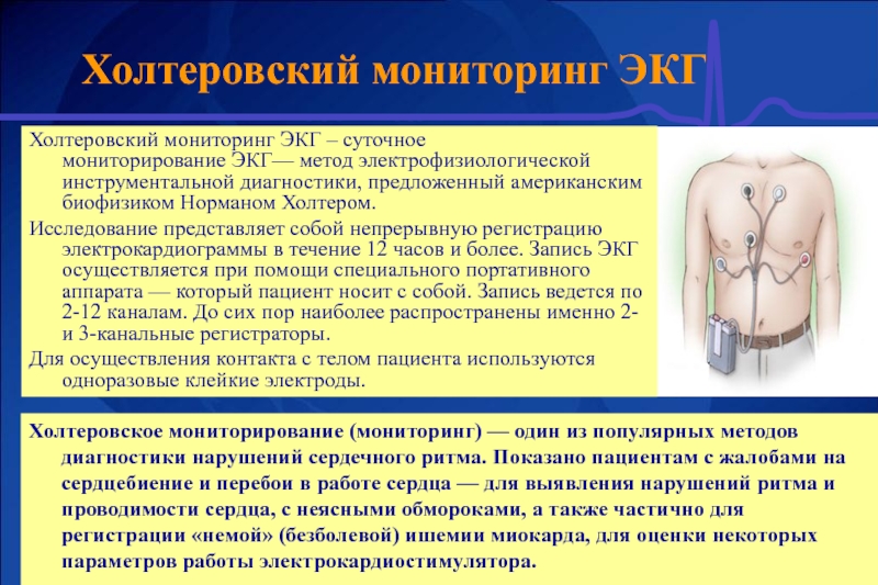 Холтеровское мониторирование презентация