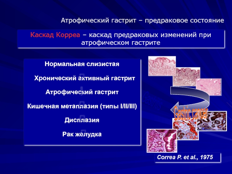 Презентация по гастриту