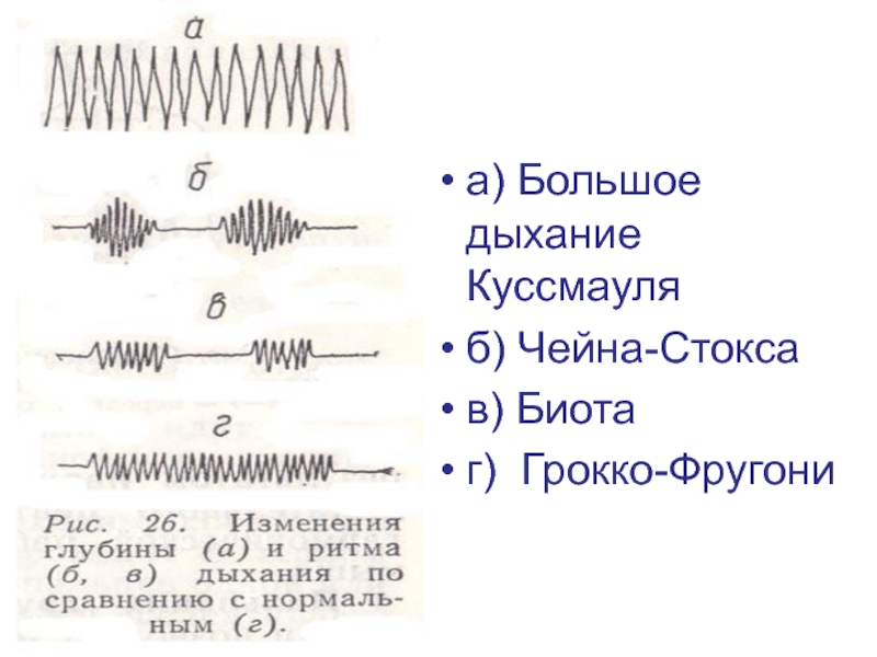 Дыхание чейна стокса схема