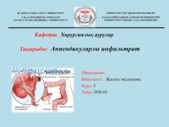 Аппендикулярлы инфильтрат