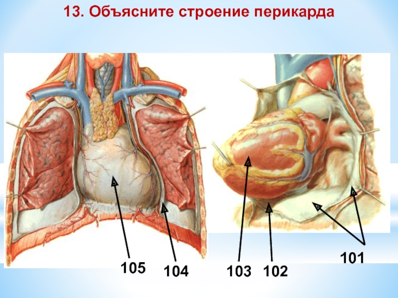 Передний нижний синус перикарда