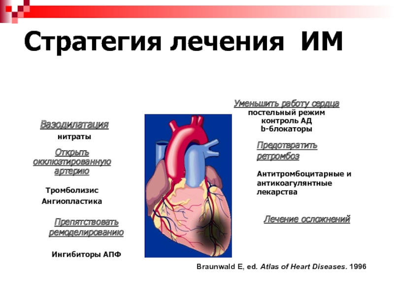 Оим это. Терапия острого инфаркта миокарда. Принципы лечения острого инфаркта миокарда. Схема лечения острого инфаркта миокарда. Презентация на тему инфаркт.