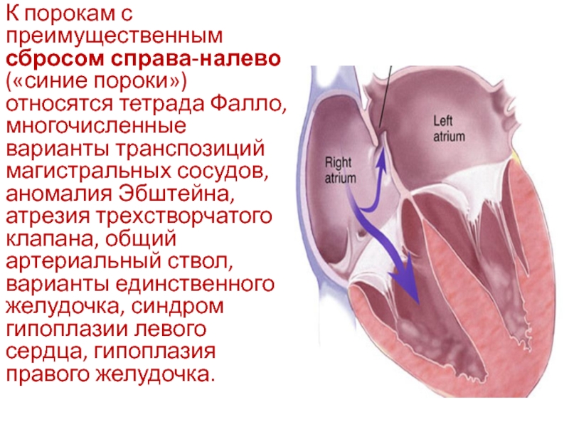 Трехстворчатый клапан сердца