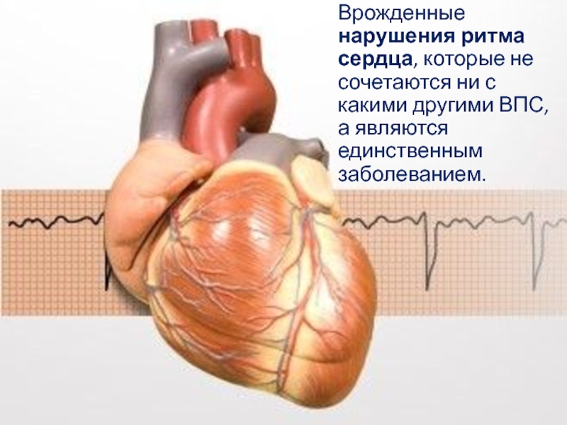 Врожденные нарушения. Пороки сердца с нарушением ритма. Нарушения ритма при пороках сердца. Врожденные нарушения сердцебиения. Несерьезные врожденные нарушения ритма сердца.