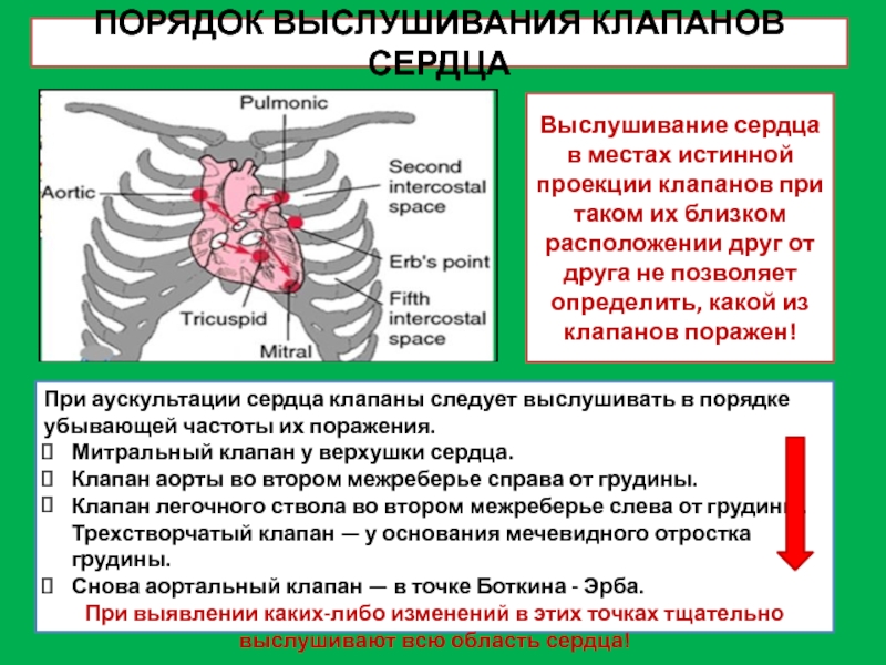 Точки аускультации сердца рисунок