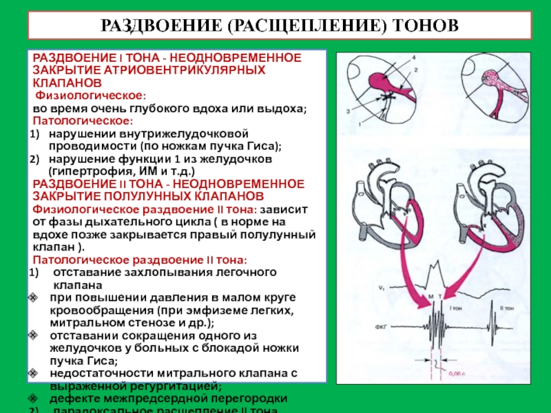 Преобладание потенциалов левого желудочка на экг. Физиологическое расщепление 1 тона. Расщепление и раздвоение тонов сердца. Причины расщепления 1 тона сердца. Раздвоение 1 тона сердца.