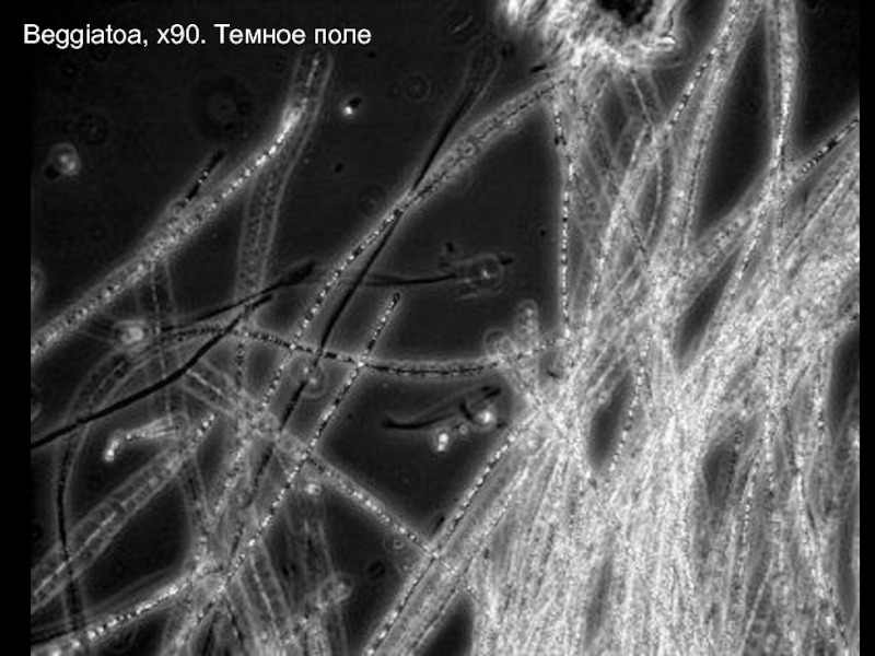 Поле микроскопа. Beggiatoa gigantea. Beggiatoa Alba. Пурпурные серобактерии микроскопия. Beggiatoa под микроскопом.