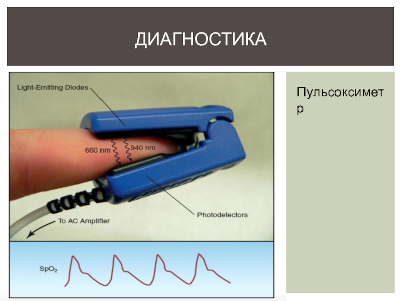 Диагностика 23. Принцип работы пульсоксим. Пульсока вая диагностика. АКМ Лайт диагностика.