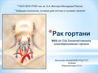 Рак гортани. Злокачественное новообразование гортани