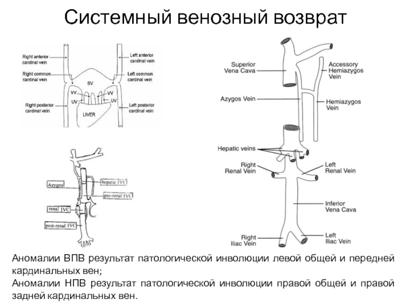 Врожденный венозный порок