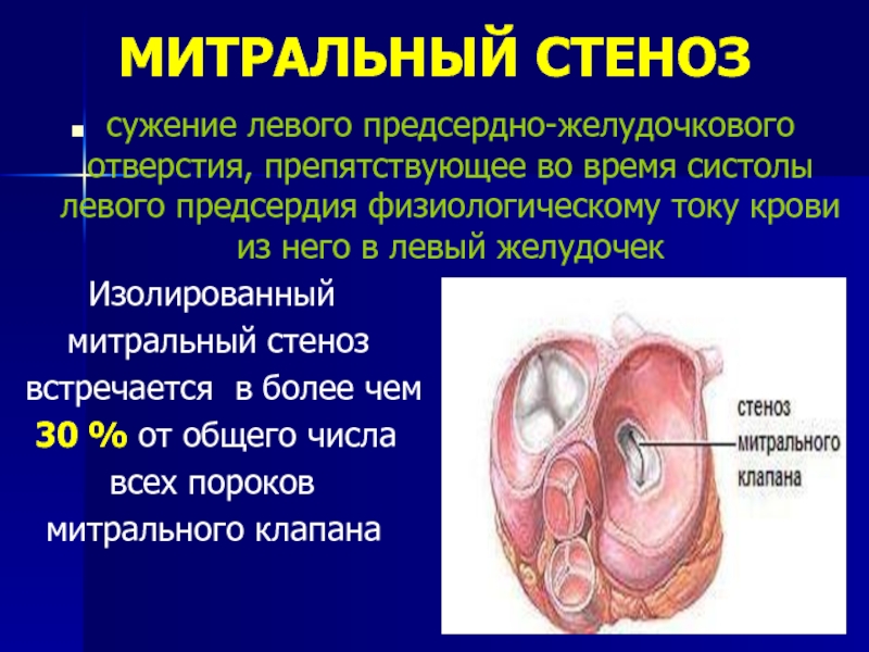 Реферат: Недостаточность клапанов и сужение отверстия легочной артерии