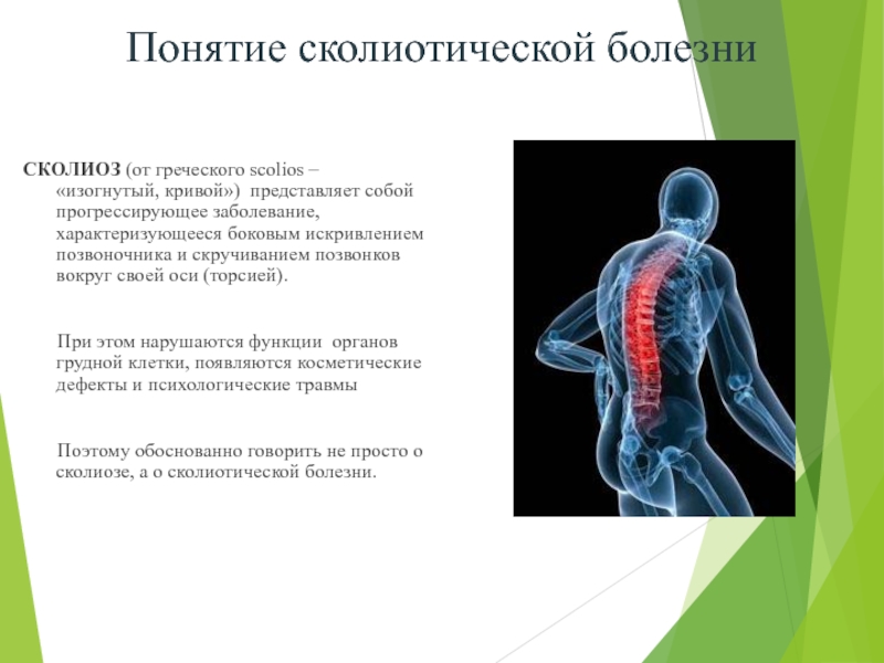 Физическая реабилитация при сколиозе презентация