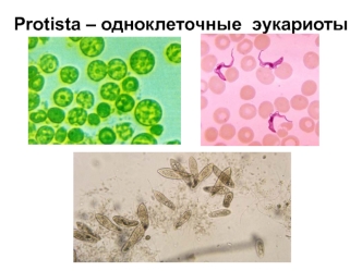 Protista – одноклеточные эукариоты