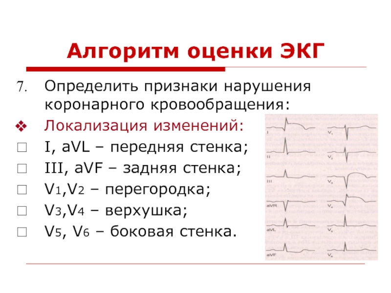 Презентация по экг