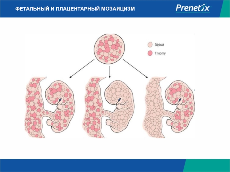 Мозаицизм. Плацентарный мозаицизм. Фетоплацентарный мозаицизм. Плацентарный мозаицизм по 21 хромосоме.