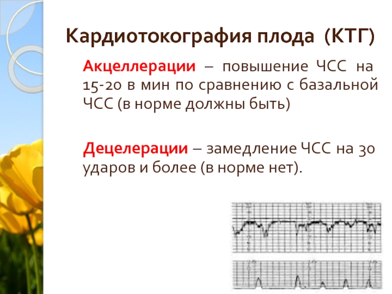 Ктг это