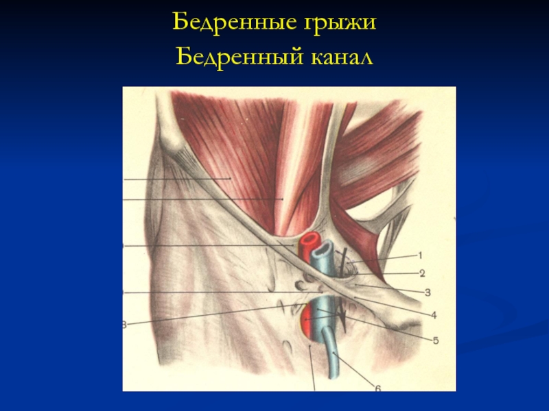 Бедренная грыжа у детей фото