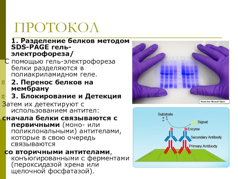 Деление белков. Разделение белков методом гель-электрофореза. На чём основано Разделение белков методом электрофореза. Разделение белков методом электрофореза. SDS-гель электрофореза.