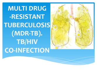 Multi drug resistant tuberculosis. MDR-TB. (Lecture 6)