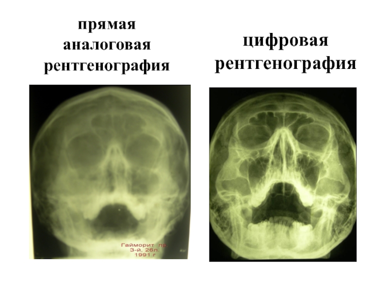 Реферат: Цифровая рентгенография