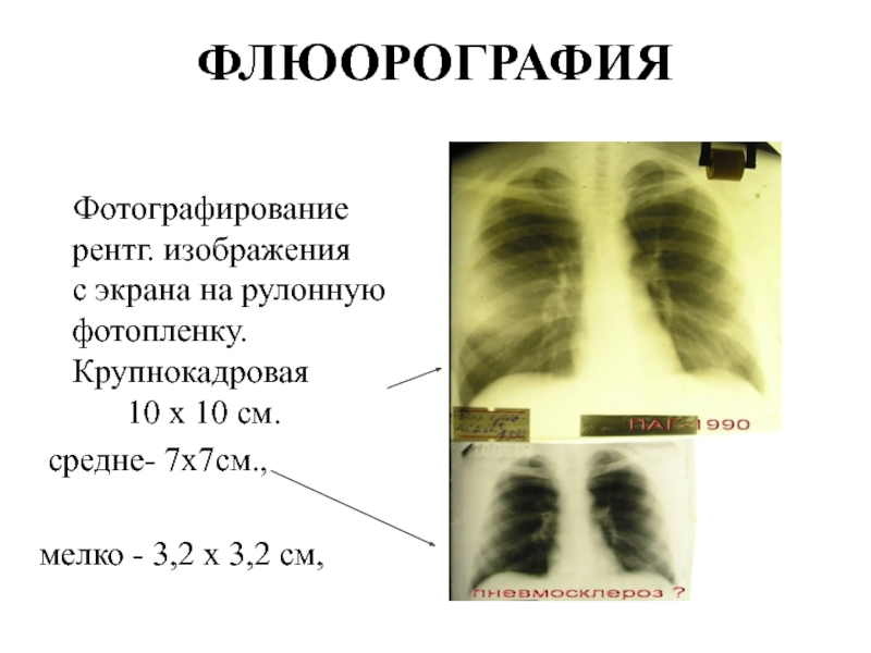 Флюорография картинки для презентации