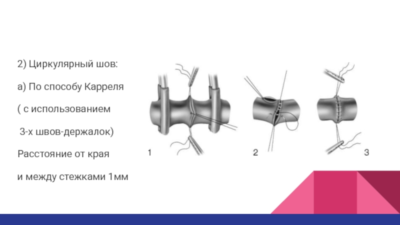 Сосудистый шов топографическая анатомия презентация