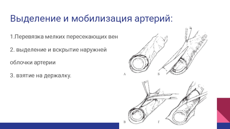 Перевязка в ране и на протяжении