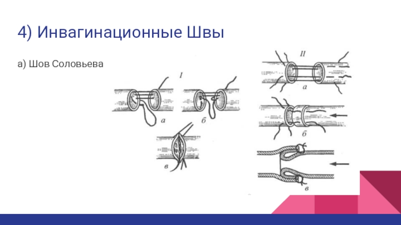 Сосудистый шов топографическая анатомия презентация