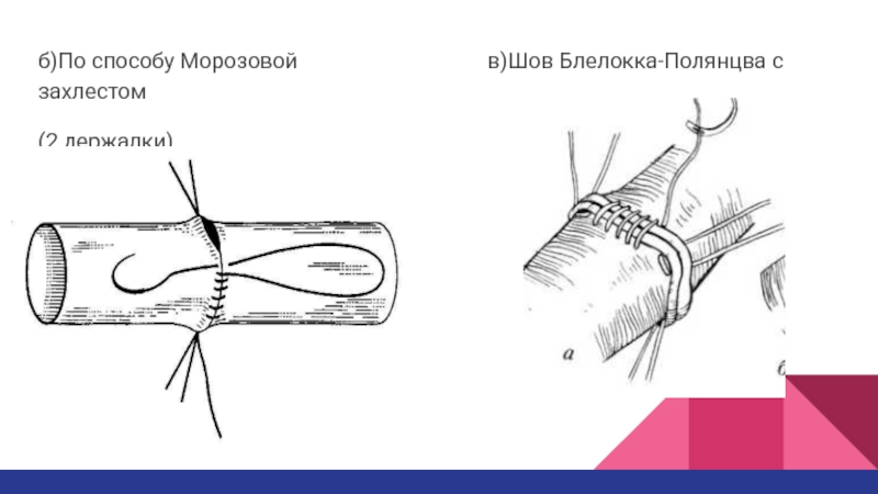 Сосудистый шов топографическая анатомия презентация