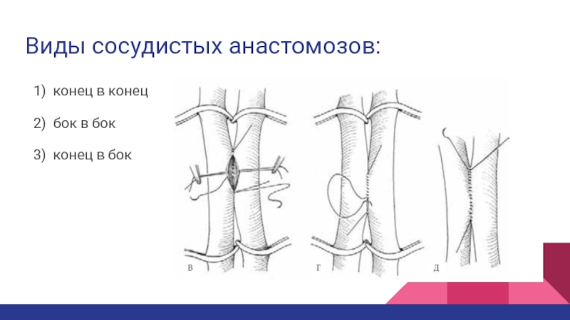 Сосудистый шов топографическая анатомия презентация